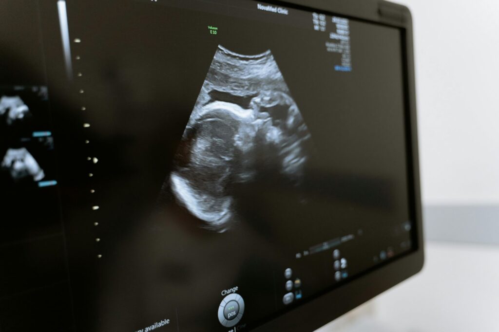 Bridging Psychology and Healthcare with Ultrasound Education